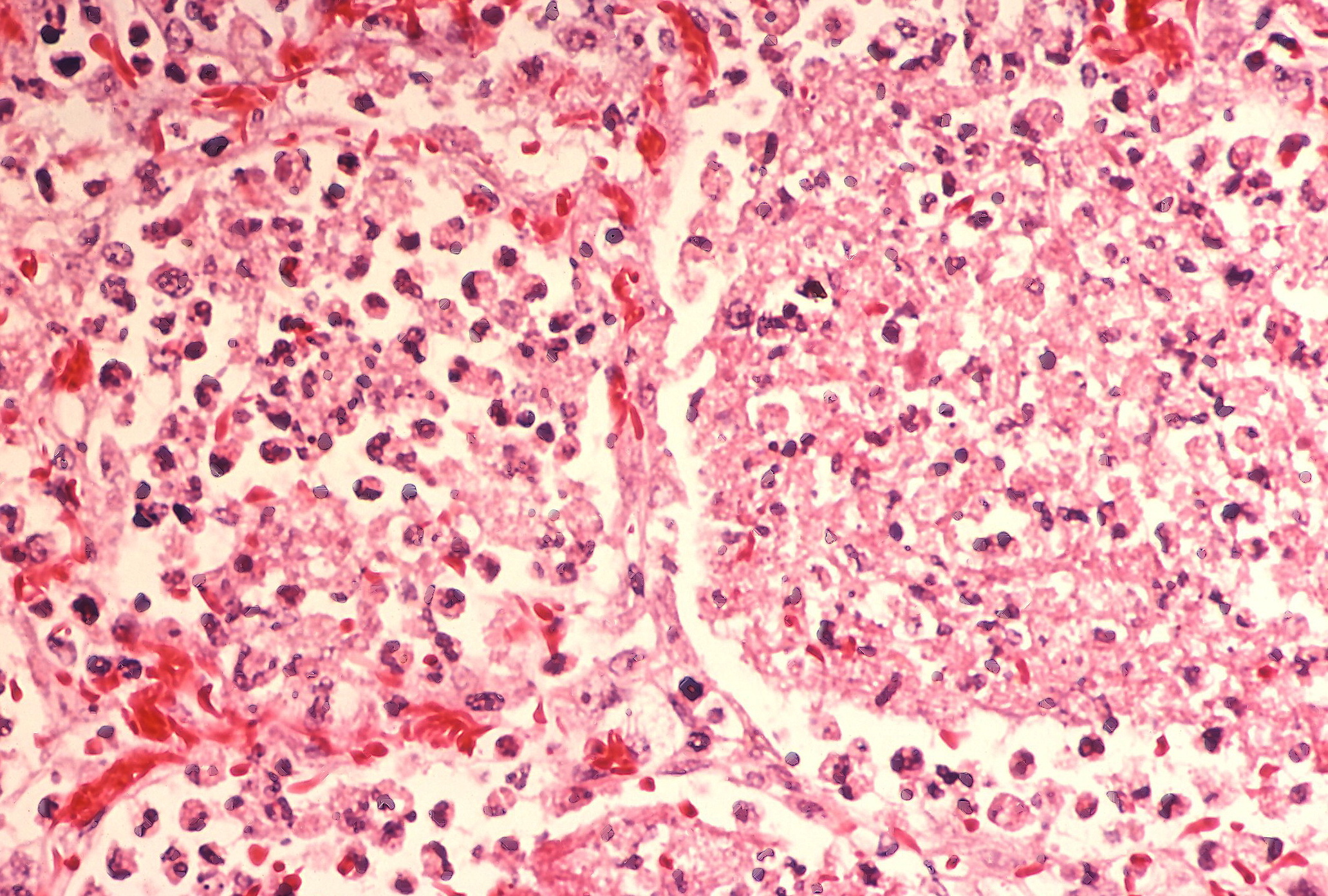 Legionnaires’ Outbreak London Ontario July 2025: Causes, Prevention & Expert Advice